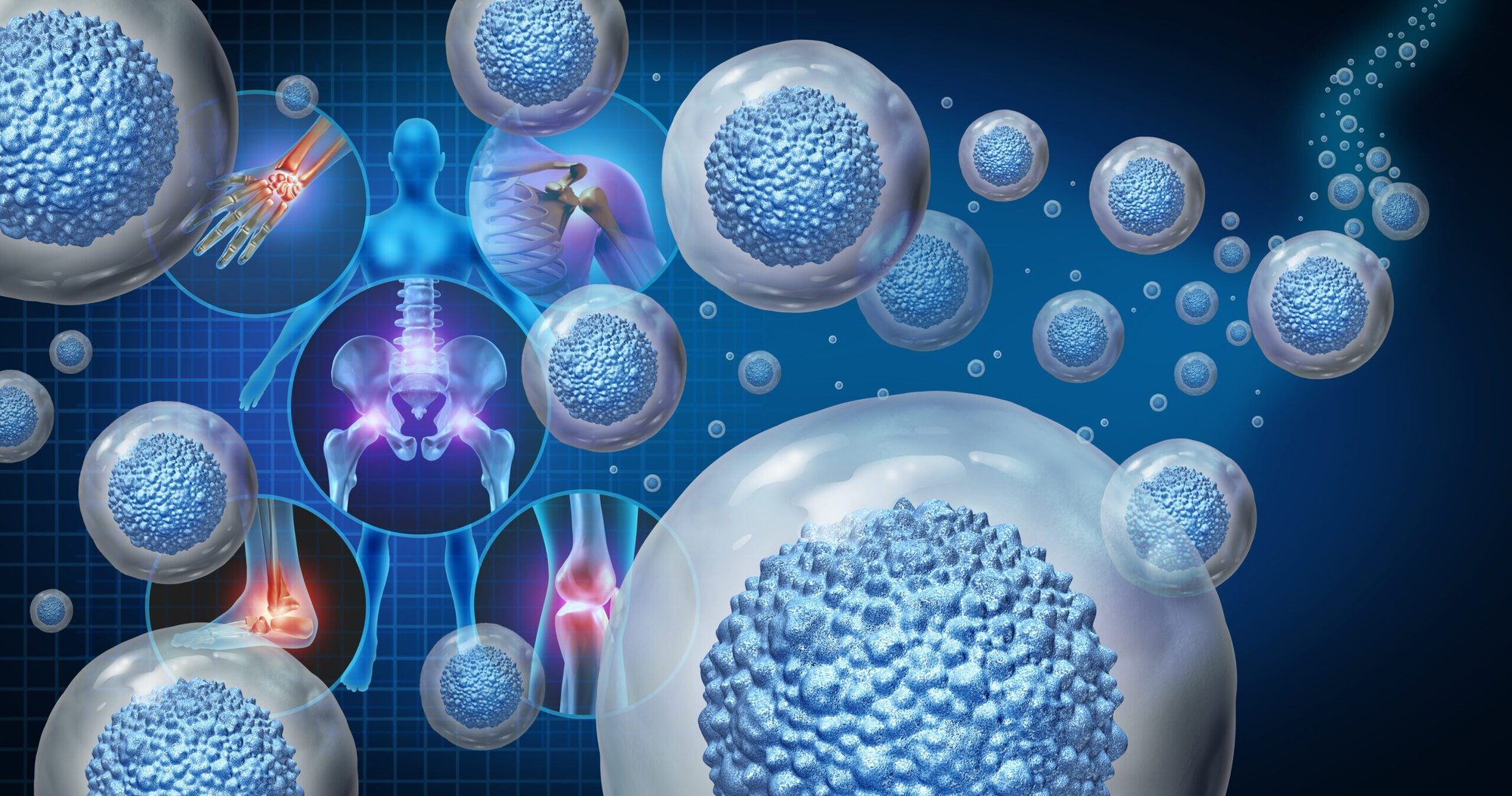 Img_Hero_Blog_Discgenics_Stem_Cell_Therapy_10102024-scaled